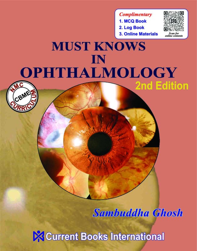 MUST KNOWS in OPHTHALMOLOGY